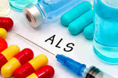 ALS组织合作，将新疗法推向试验阶段