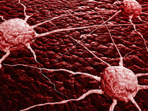 Meta分析鉴定了睾丸癌的四种新的遗传危险因素