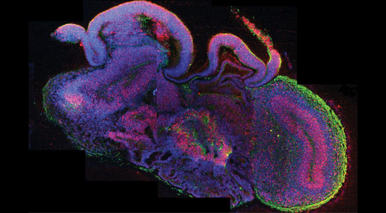 科学家在3D文化系统中生长人脑组织