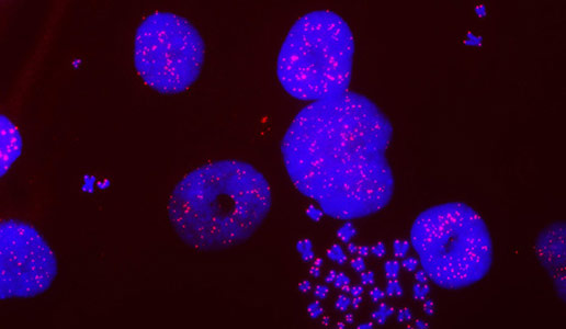 耶鲁研究人员发现新的癌细胞脆弱性