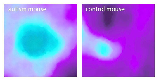 神经生物学家审视蒙塞尔皮质，可以在自闭症中发挥重要作用