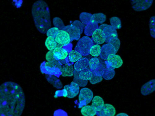 研究人员将人类多能干细胞重置为完全原始状态
