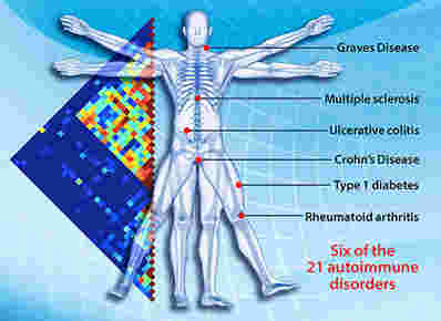 分子映射定位自身免疫疾病的遗传变异