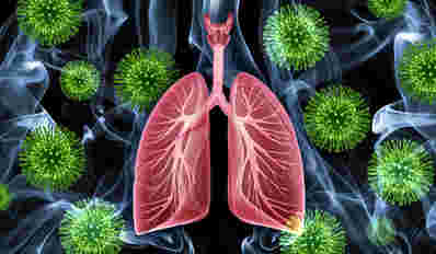 维生素A受体有助于保护肺免受烟雾暴露和病毒感染