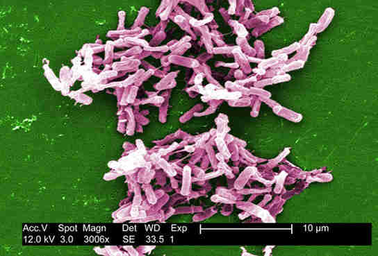 研究表明细菌感染，C. Dificile，美国普及