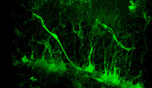 耶鲁神经生物学家发现令人惊讶的新脑细胞增长触发