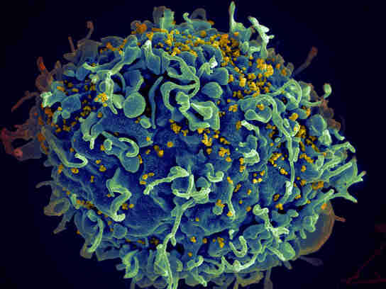新的抗HIV候选块的每种菌株HIV-1，HIV-2和SIV
