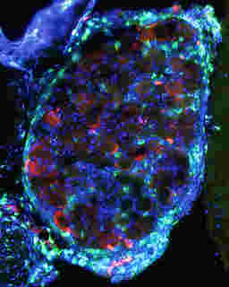 耶鲁大学的研究人员揭示了抗体如何进入神经元以抵抗感染
