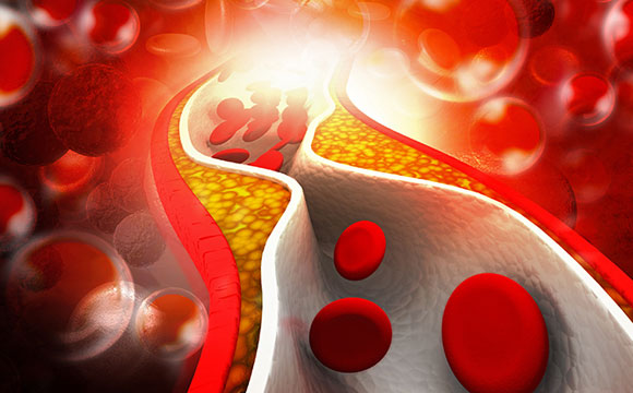 耶鲁大学研究人员确定控制胆固醇的RNA