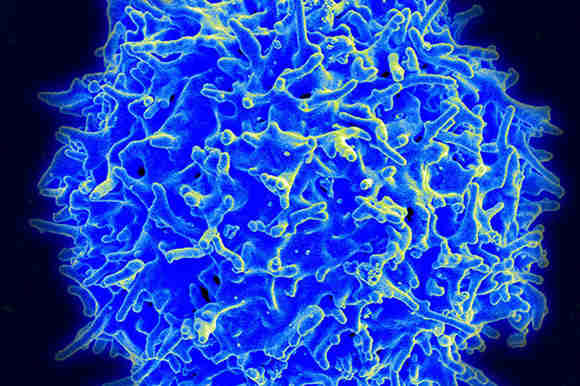 一个有希望的癌症的新形式的免疫疗法