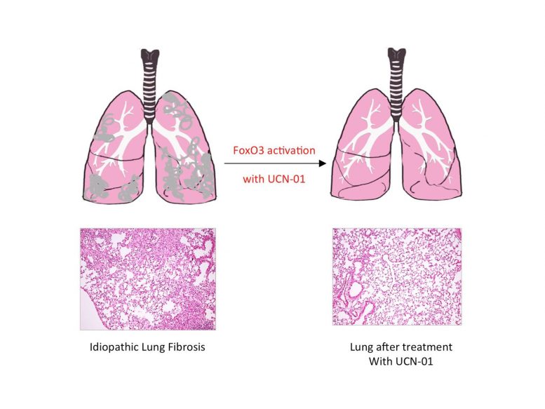 提升FoxO3活性停止肺纤维化的进展