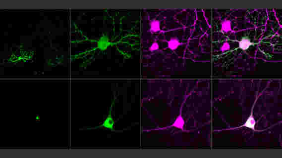 研究人员使用下一代视神经理来控制单一神经元