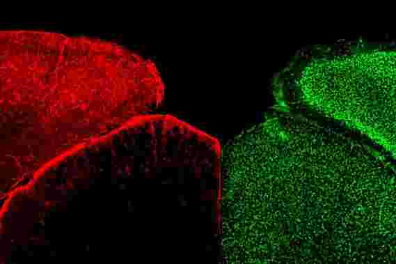 星形胶质细胞神经元相互作用可能会对脑疾病提供洞察力