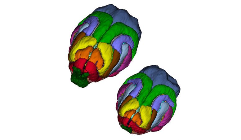 科学家识别几种导致异常小头的基因