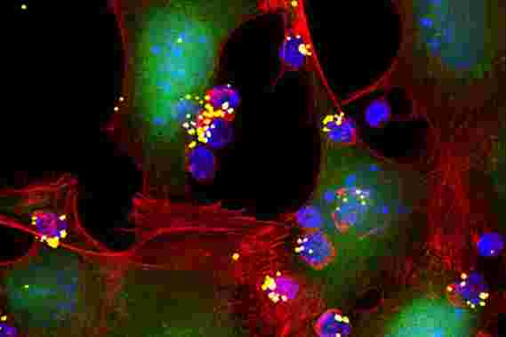 麻省理工学院设计的纳米颗粒增强免疫细胞