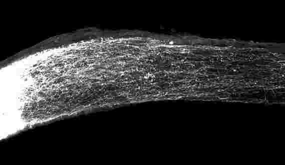 研究人员在神经细胞中再生轴突被脊髓损伤切断的