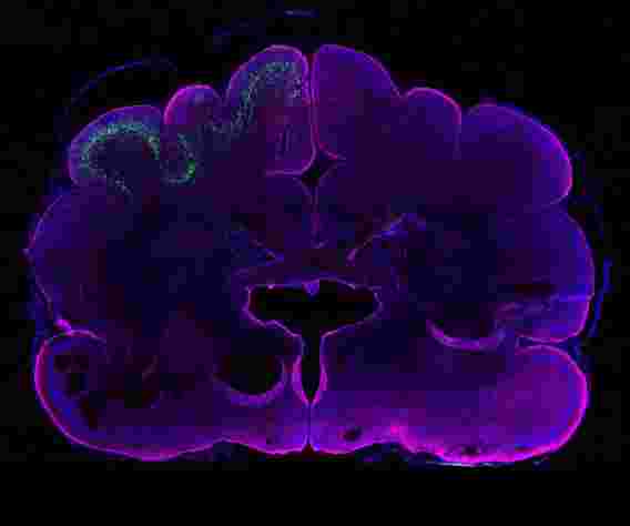 研究人员发现构建更大的大脑的人体特异性基因
