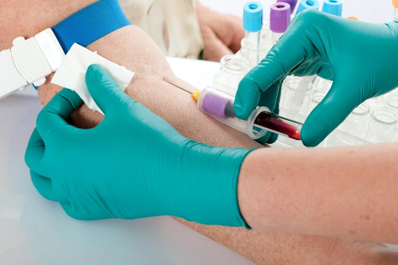 血液测试可以代替更多的肺癌患者的活检