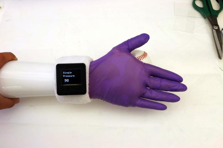 令人难以置信的电子手套为假肢手提供“人类的”功能[视频]