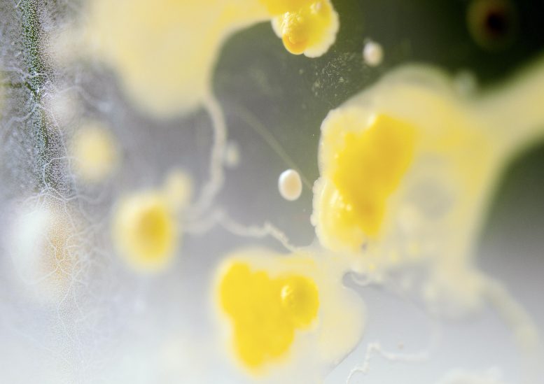 开拓性研究揭示了某些与肠道细菌有关的人类基因