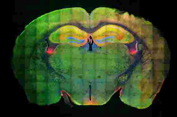 麻省理工学院的神经科学家发现了一种允许记忆形成的分子机制