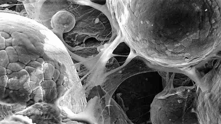 “冷喷”技术：具有超声速度的3D印刷生物医学零件