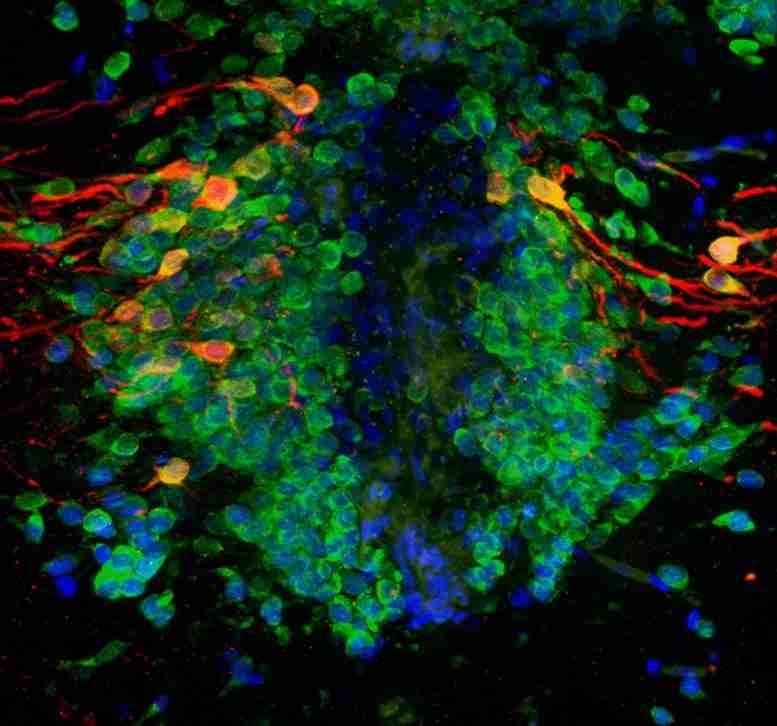 帕金森氏症的基因PINK1可能会损害我们一生中如何制造新的神经元