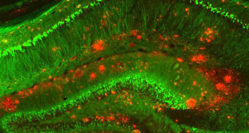 阿尔茨海默氏物的蛋白质可以从血液中出发到大脑中
