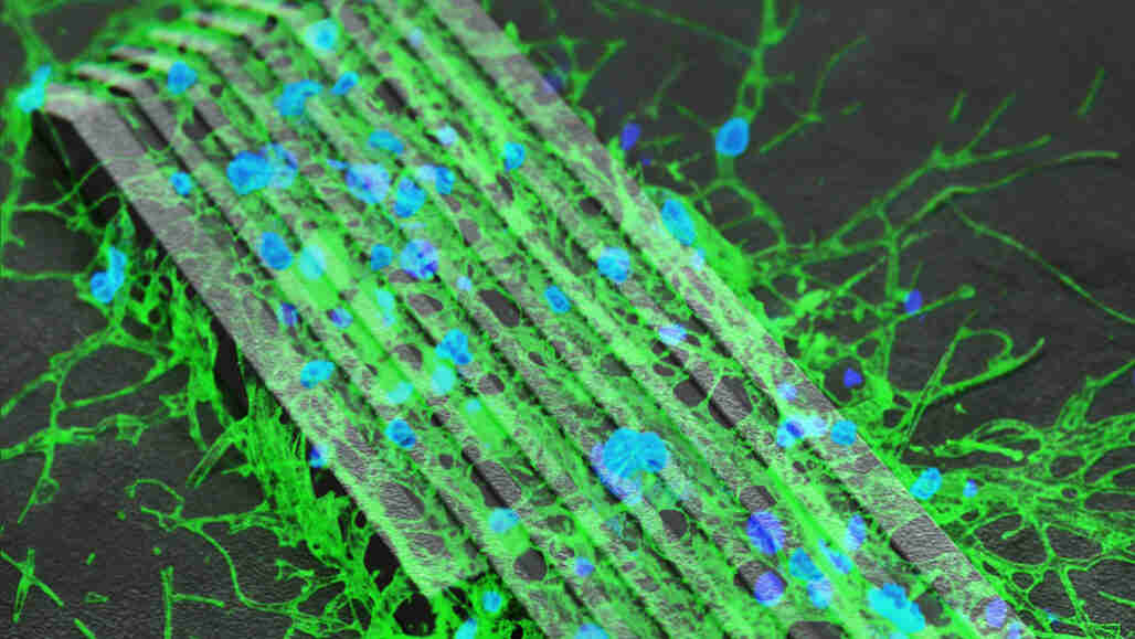 微小的磁控机器人哄骨神经细胞生长连接