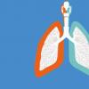 我们应该在预防肺癌中寻找什么？