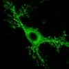 苔藓脑细胞与记忆损失和癫痫发作相关联