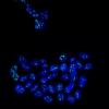 突破性发现揭示了MSK1蛋白质保持转移性乳腺癌细胞休眠