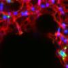 科学家发现预测哮喘患病风险的生物标志物