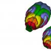 科学家识别几种导致异常小头的基因