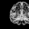 孩子的大脑真的变得更薄吗？神经科学家引人注目的结果是出乎意料的。