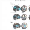 成像暮光区：大脑网络推动意识变化