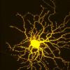 将神经变性疾病从青光眼治疗到Alzheimer：关于如何保护神经元并鼓励其增长的新发现