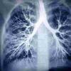 雾化大麻比雾化或吸烟尼古丁造成的肺损伤更多
