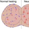 科学家发现新的细胞类型涉及慢性疼痛和炎症 - 精确，新的治疗目标