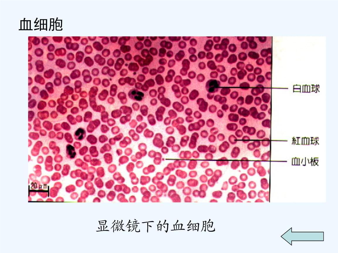 血浆 血清_血清是血浆吗_血浆变血清