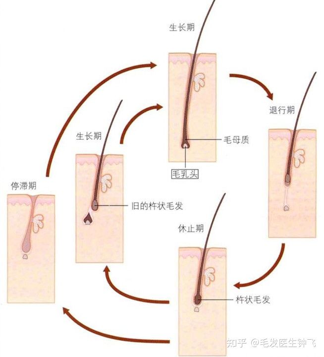 
毛周角化症即毛孔角化症怎么办？怎么治疗效果好？