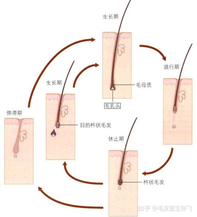 
毛周角化症即毛孔角化症怎么办？怎么治疗效果好？