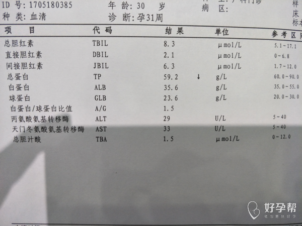 重组人血清白蛋白_人血清白蛋白纳米粒_血清白蛋白测定偏低