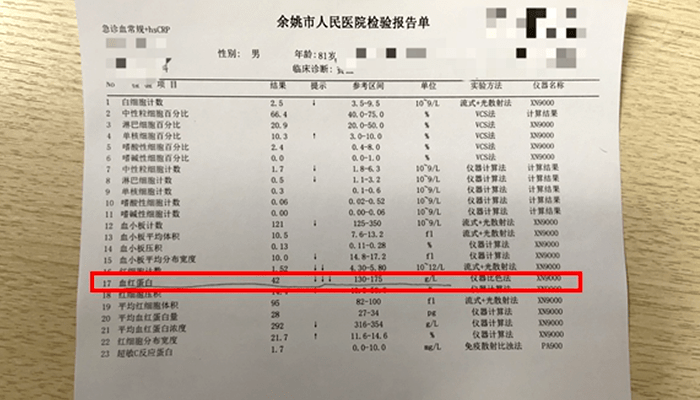 血清白蛋白异常