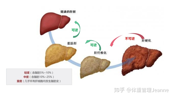 熬夜是关键的诱发因素之一加重肝脏的负担(图)