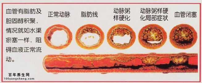 脂肪属于什么组织_乙型肝炎病毒外膜蛋白前s1抗原 阴性_心外膜脂肪组织