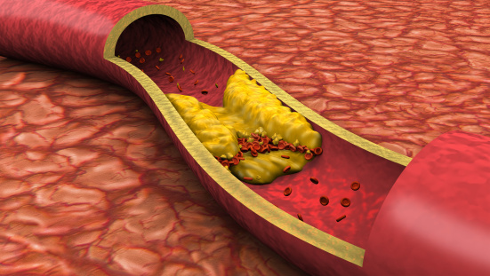 脂肪属于什么组织_心外膜脂肪组织_乙型肝炎病毒外膜蛋白前s1抗原 阴性