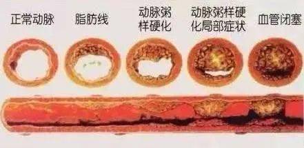 脂肪属于什么组织_乙型肝炎病毒外膜蛋白前s1抗原 阴性_心外膜脂肪组织