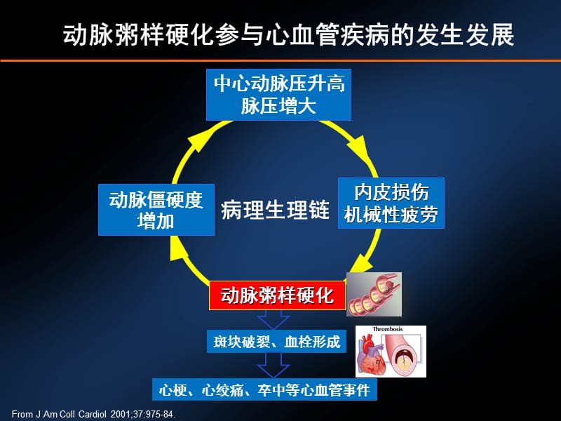 阻塞性-1如何加强颈动脉体活动的详细机制_温州助听器