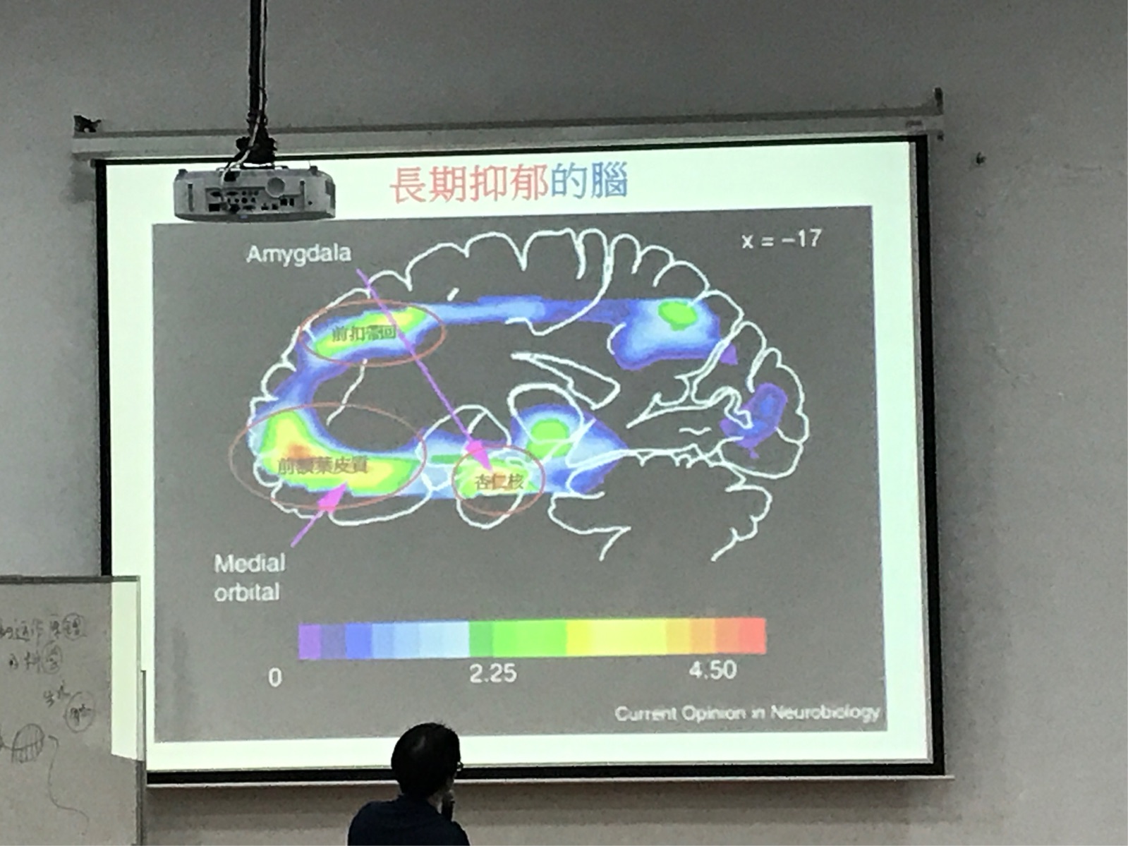 大脑分泌多巴胺_跑步分泌多巴胺_怎么分泌多巴胺